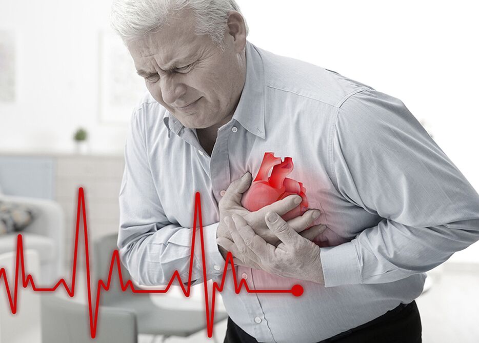 liečba srdcových chorôb pomocou Cardione